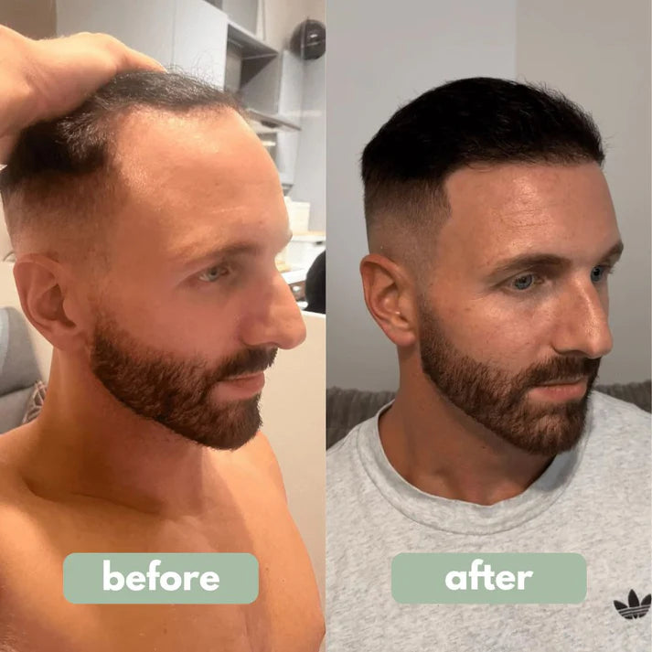 Dermaevra™ Hair Growth Serum