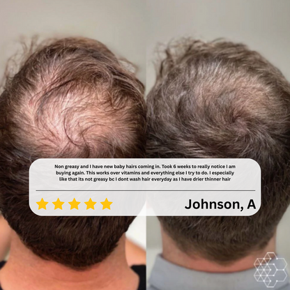 Dermaevra™ Hair Growth Serum